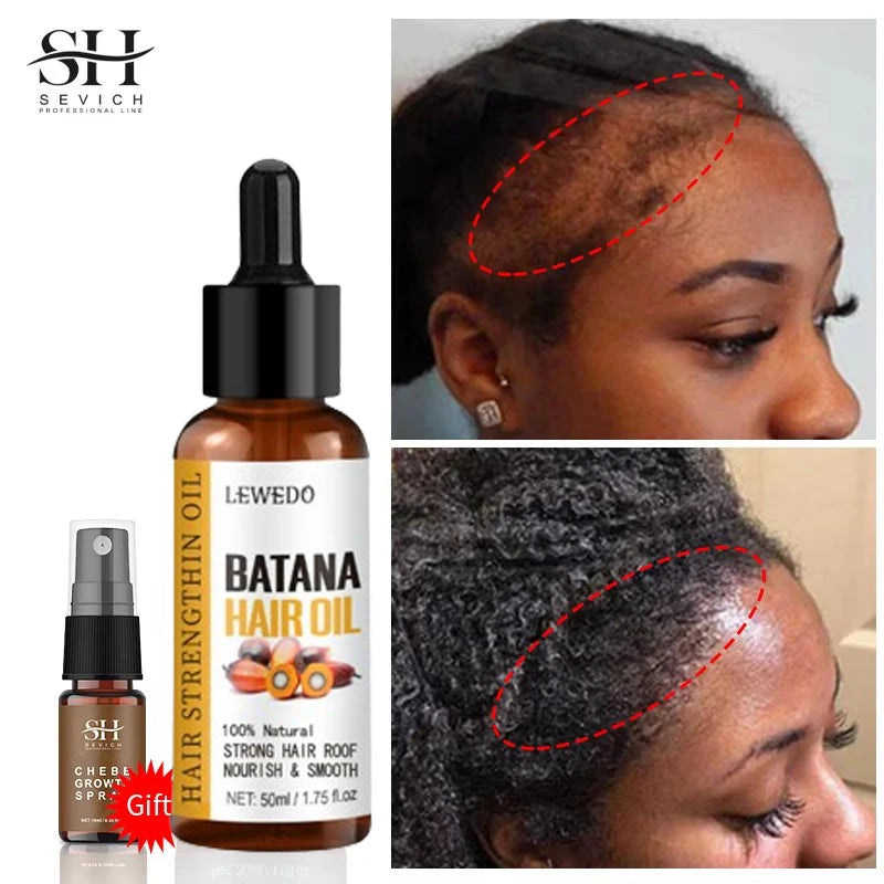Hair Growth Batana Oil Serum Fast Growing Hair Essential Oil Beauty Hair Care Anti-Hair Loss Essence Natural Repair Damaged Hair